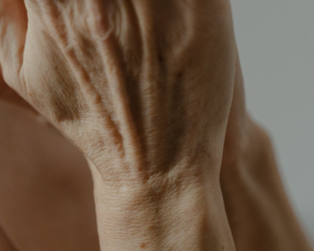 skin symptoms of rheumatoid arthritis