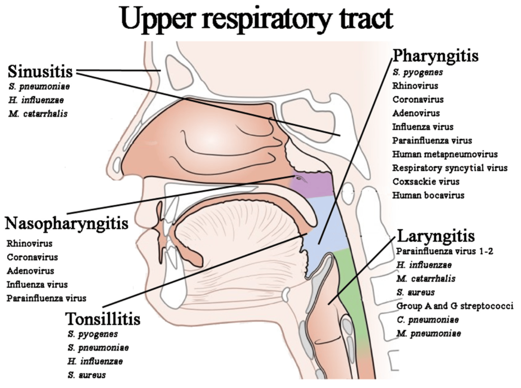 Types of upper respiratory tract infections